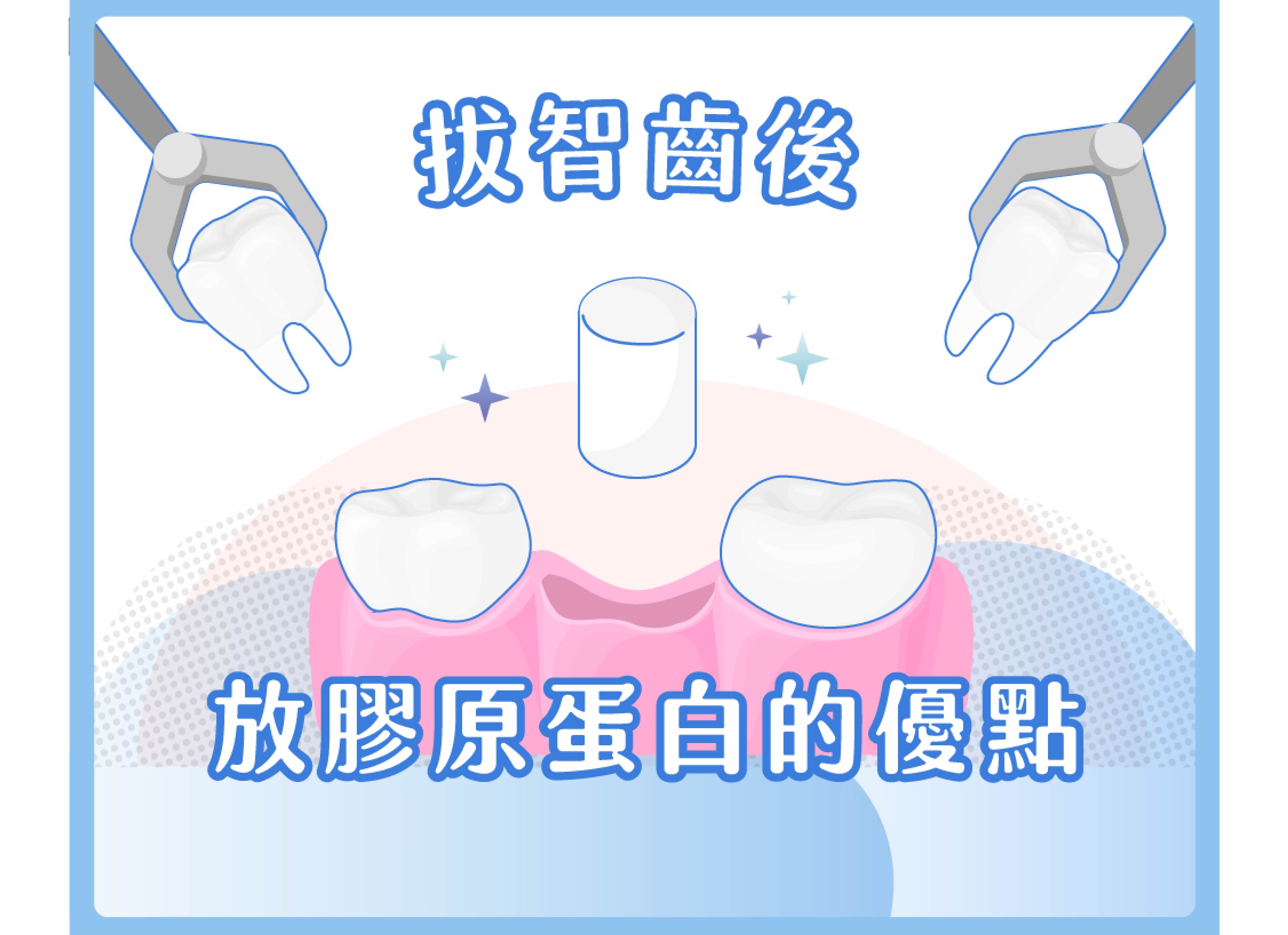 拔牙、拔智齒時放入傷口的膠原蛋白是?優點是? 廖彥翔醫師 和大家分享